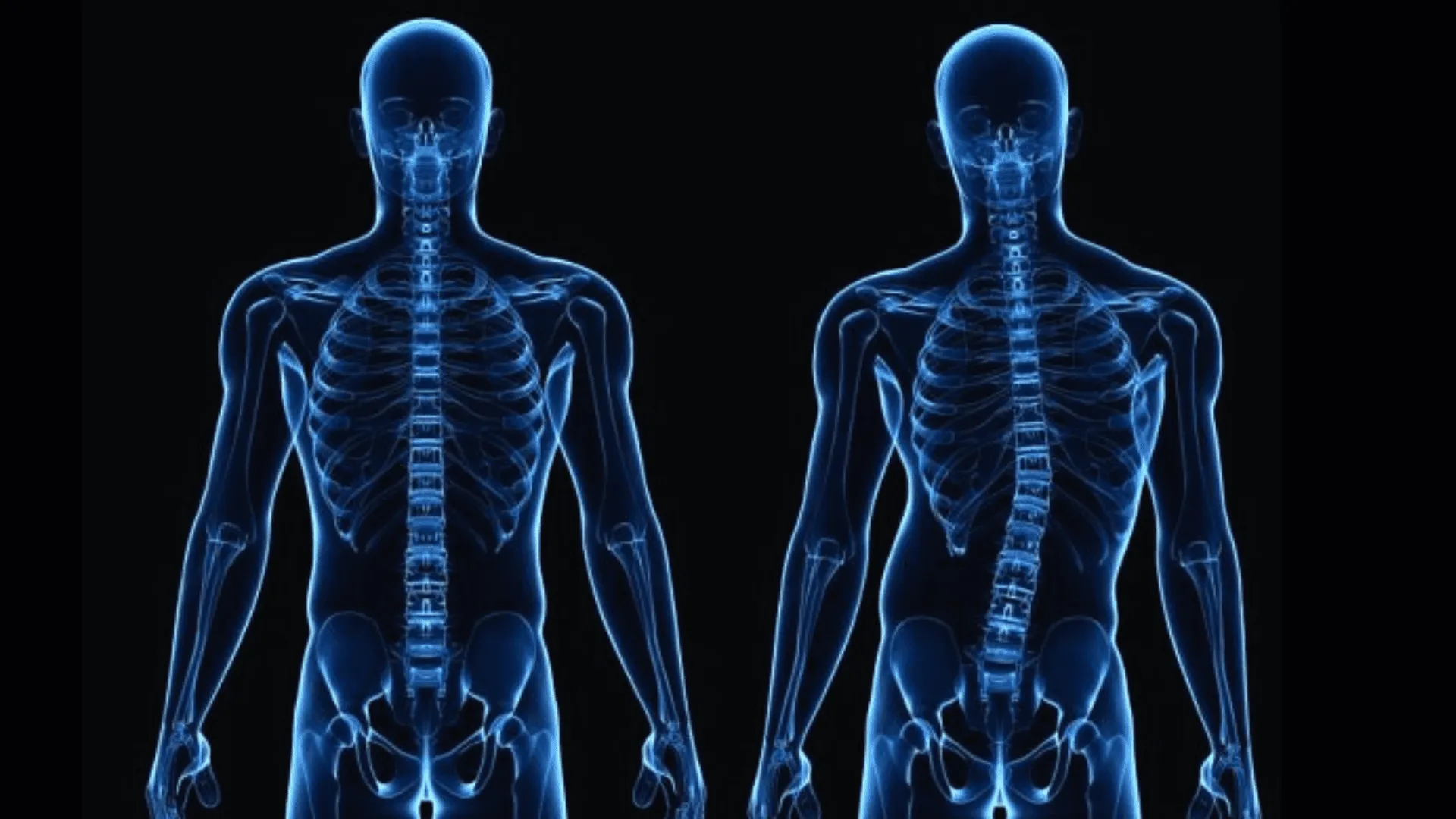 Spinal Deformity Correction