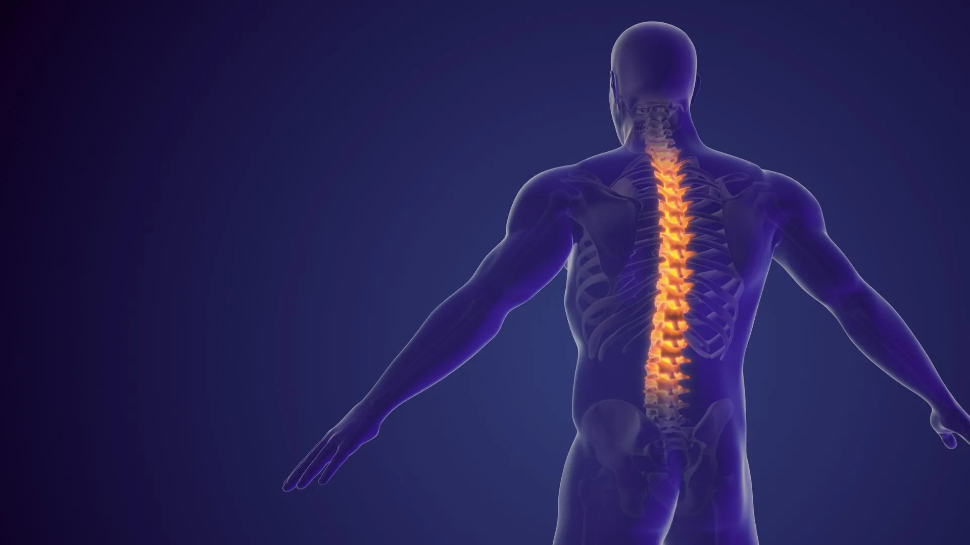 Spinal Fusion Surgery
