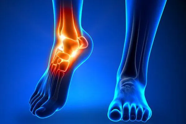 Ankle Replacement Surgery